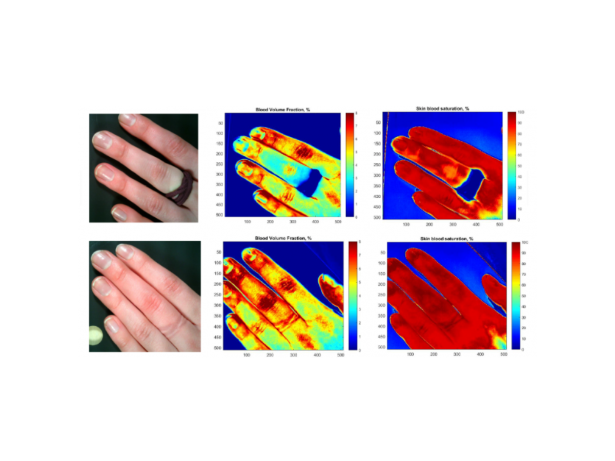 Side by side images showing finger occlusion and related blood volume fraction and skin blood saturation using hyperspectral imaging